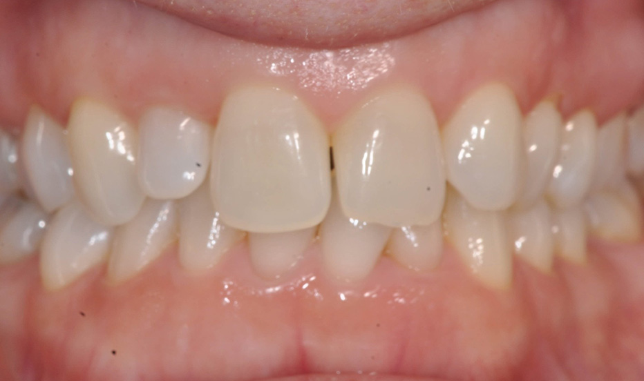 Efter - Exempel 3: Tandhygienist - Smile Vänersborg